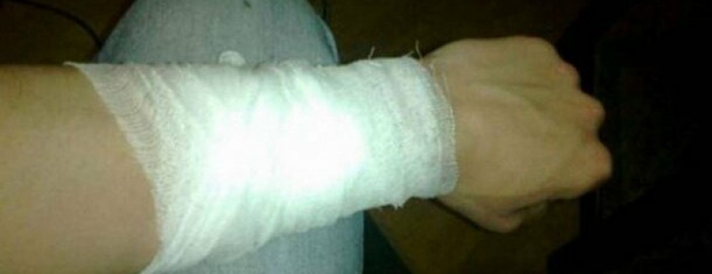 У Тернополі чоловік отримав колоту рану просто на вулиці