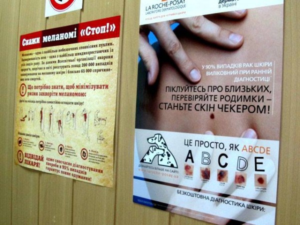 У Тернополі безкоштовно обстежать родимки через ризик раку