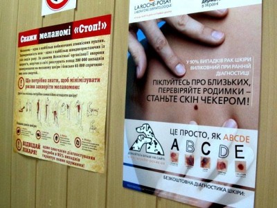 У Тернополі безкоштовно обстежать родимки через ризик раку
